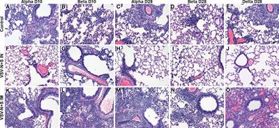 Protection from COVID-19 with a VSV-based vaccine expressing the spike and nucleocapsid proteins